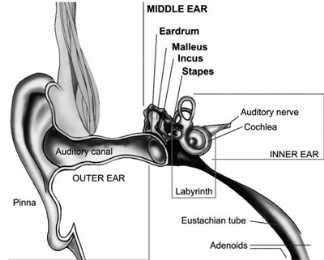 Diagram of the ear showing the outer ear parts: pinna and auditory canal. Middle ear parts: eardrum, malleus, incus, and stapes. Inner ear parts shown: auditory nerve, cochlea, and labyrinth. Also shown are the eustachian tube and adenoids.