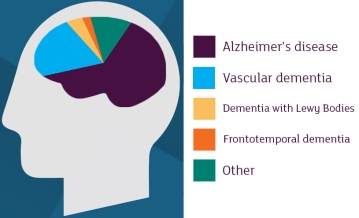 Types of dementia