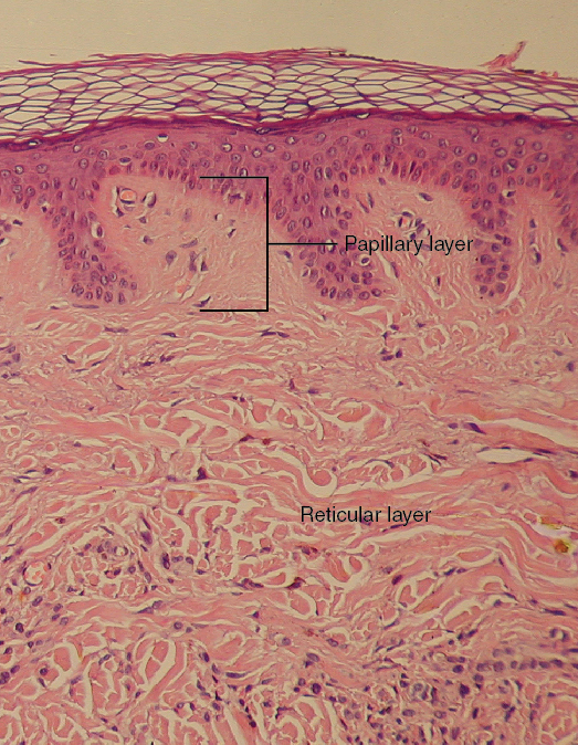 This micrograph shows layers of skin in a cross section.
