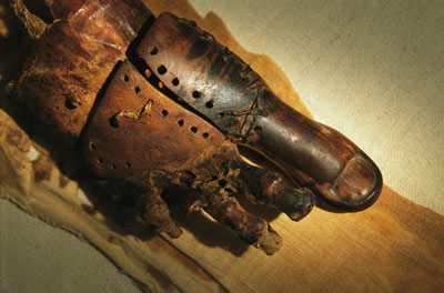 This prosthetic toe dates back to between 950 and 710 B.C.