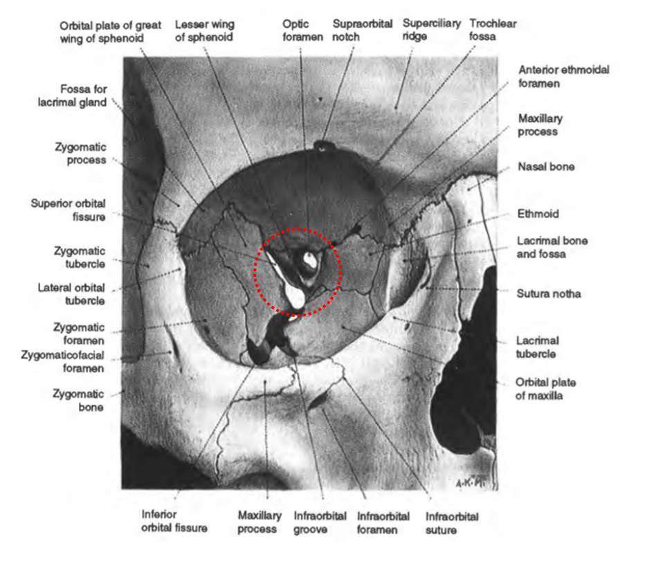 Anatomy Of The Posterior Orbit And Orbital Apex